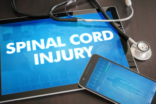 San Jose Personal Injury Attorney